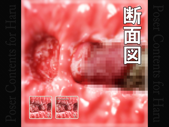 Sectional View of Vaginal for Haru